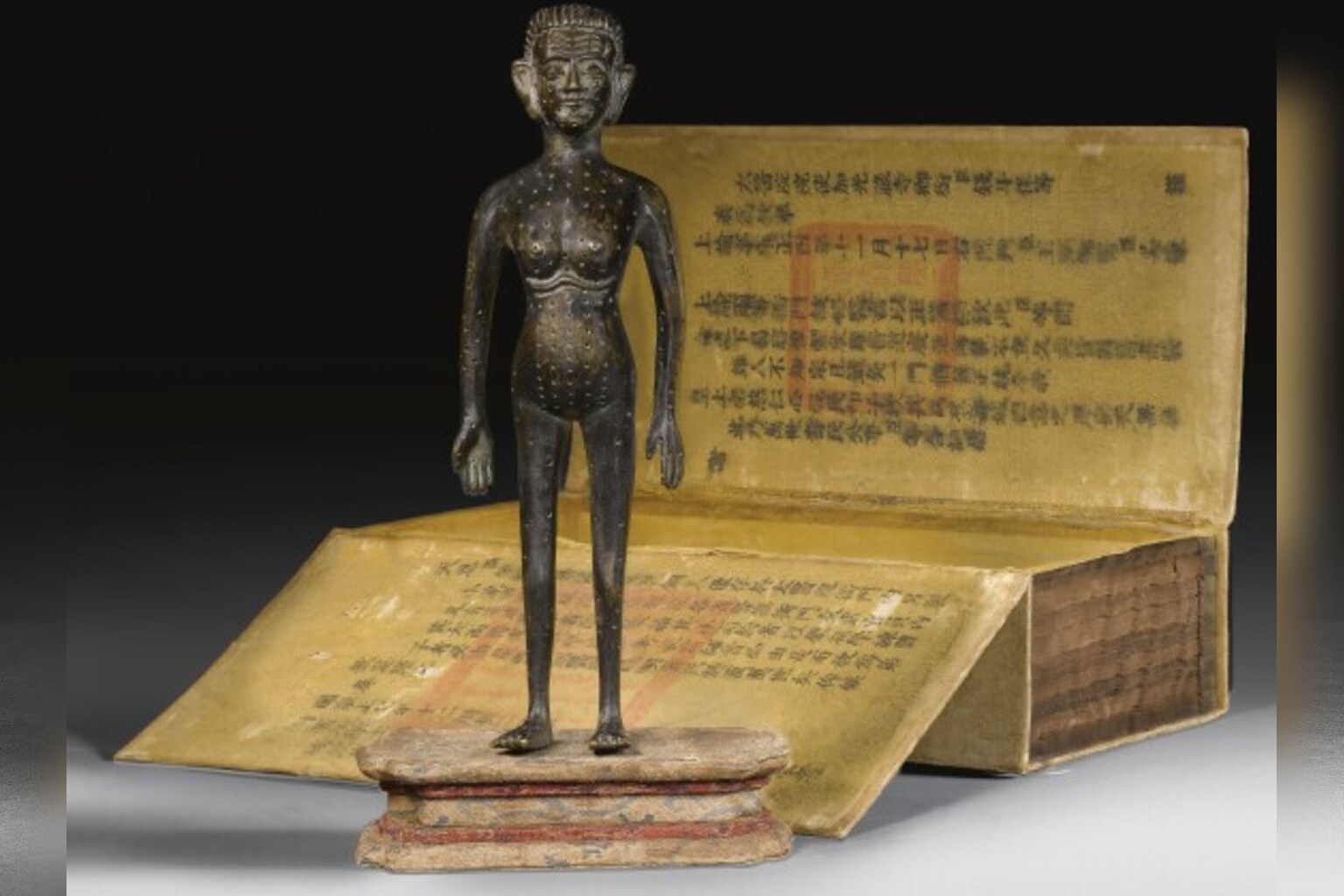 Imagen de portada de «5 Beneficios de la Acupuntura que Equilibran Cuerpo, Mente y Espíritu».